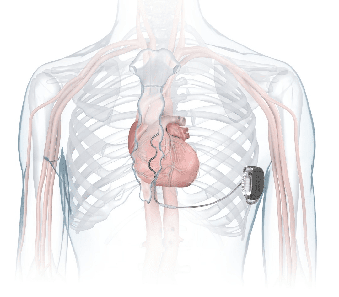 Cardiology